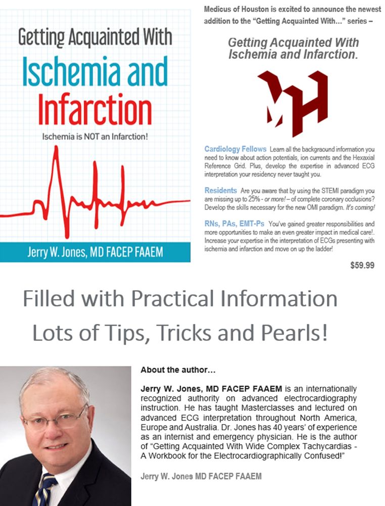 Why is ST depression called "ischemia" and ST elevation called "infarction?" Is ST elevation REALLY an infarction, and - if so - why are we "treating" dead tissue? Are you aware that by following the STEMI paradigm, you are missing 25 - 30% of acute coronary artery occlusions that would benefit from immediate revascularization in the cath lab? Have you ever wondered why some acute "MIs" have no recognizable changes on the ECG? Or... do they?

Learn about everything you were never taught about acute myocardial  ischemias! And learn which ideas you may have about ischemia are completely false and misleading!

"Getting Acquainted With Ischemia and Infarction - Ischemia Is NOT an  Infarction!" will greatly enhance your ability to recognize very subtle ECG changes indicative of acute transmural ischemia. Sharpen your diagnostic skills while expanding your knowledge!

Available on amazon.com and barnesandnoble.com.
