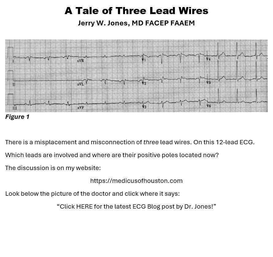 Three electrodes have been malpositioned - but which ones?