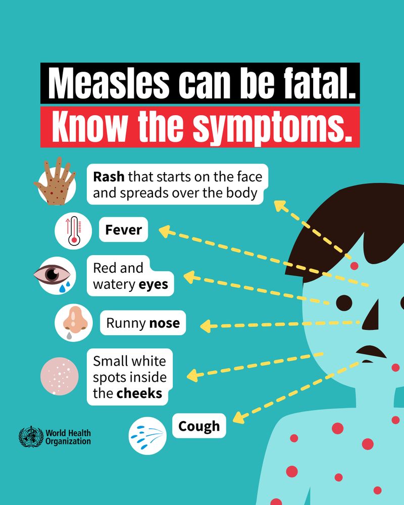 Illustration of a child with spots on the skin. Text reads 'Measles can be fatal. Know the symptoms. 
- Rash that starts on the face and spreads over the body
- Fever
- Red and watery eyes
- Runny nose
- Small white spots inside the cheeks
- Cough'