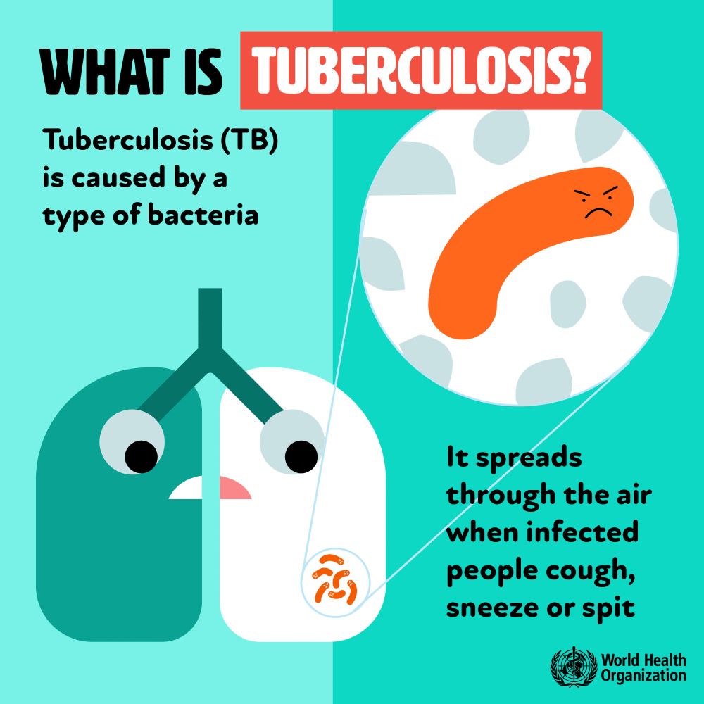 What is tuberculosis? Tuberculosis (TB) is caused by a type of bacteria. It spreads through the air when infected people cough sneeze or spit
