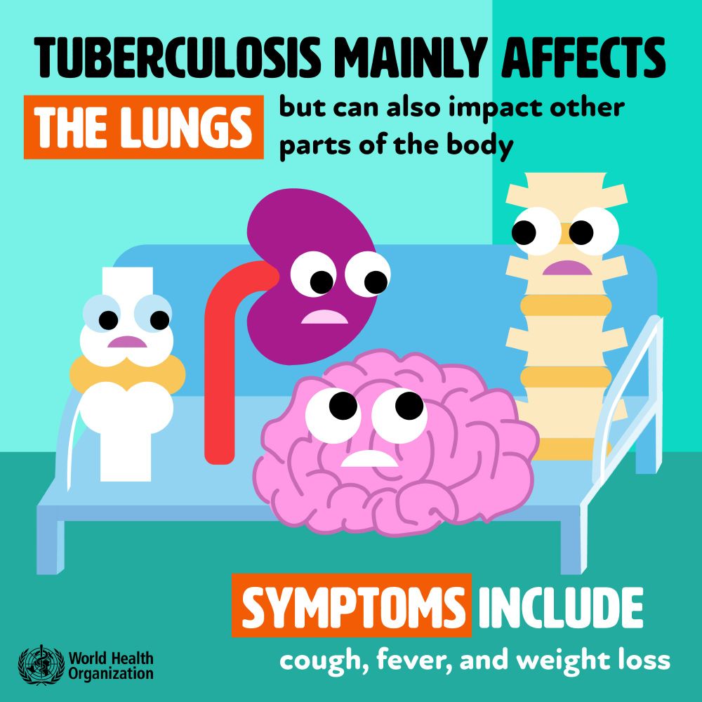 Tuberculosis mainly affects the lungs but can also impact other parts of the body. Symptoms include cough, fever and weight loss.