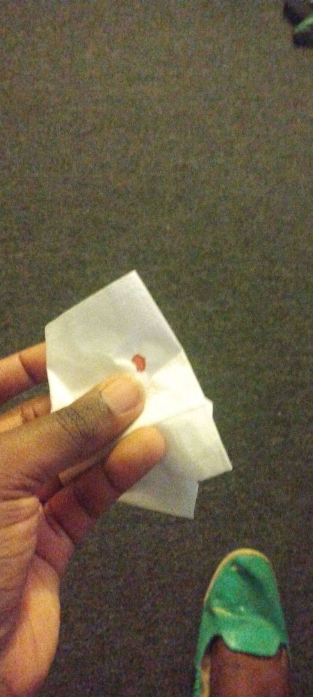 A picture of the remnants of a bedbug I'd captured, but squeezed a little too hard, to show to my building manager.