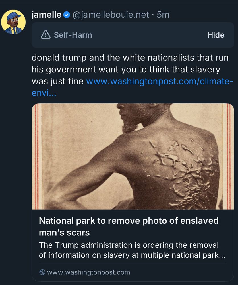 A photo of an enslaved man’s scars that BlueSky labeled “Self-Harm”