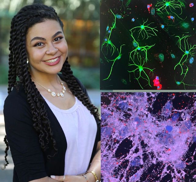 A collage of Sydney Floryanzia (a Black woman with twists) on the left crossing her arms and smiling for a professional photo, and two microscopy images of her research on the right.