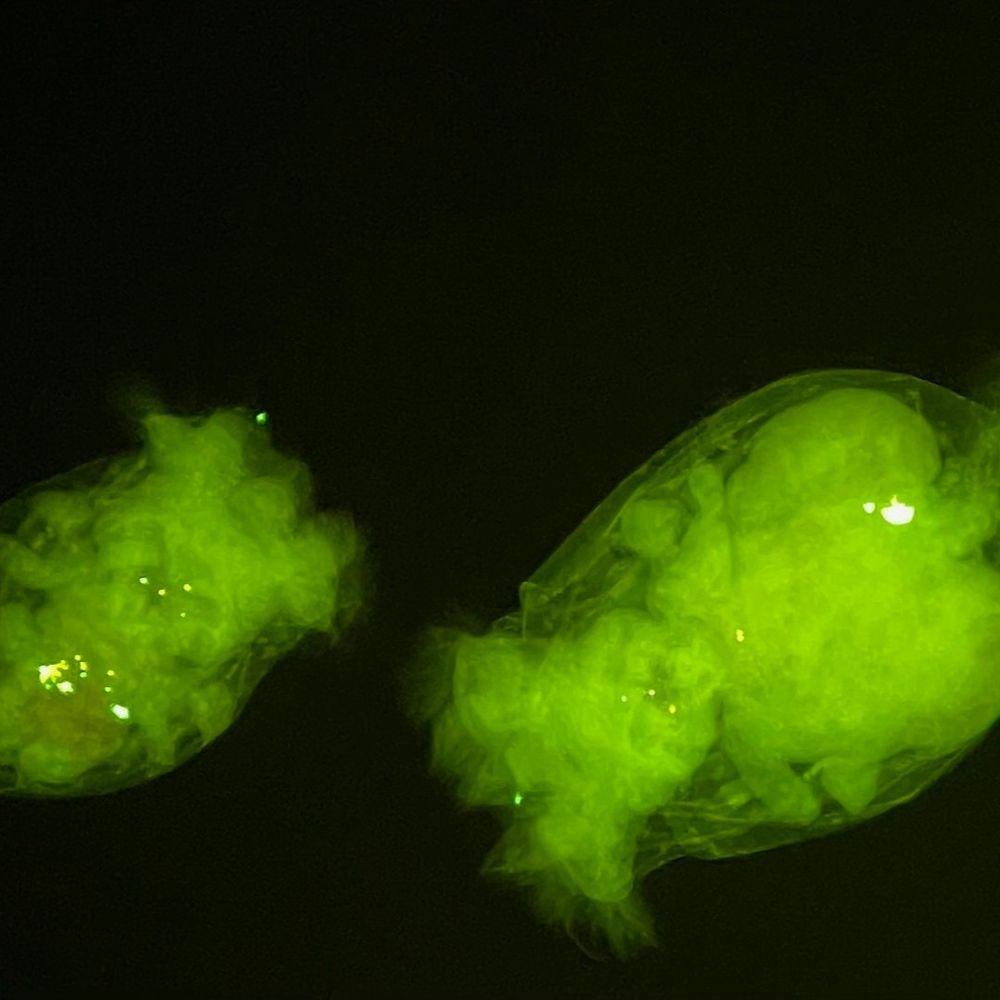 two roundish glowing green rotifers with bright green dots in them on a black background