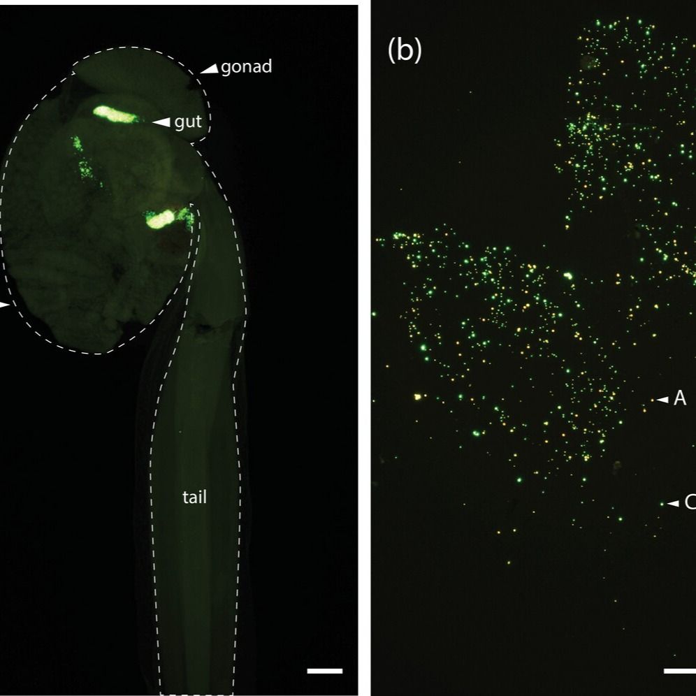 a microscope image of an appendicularian body and house on a black background with glowing green artificial food particles