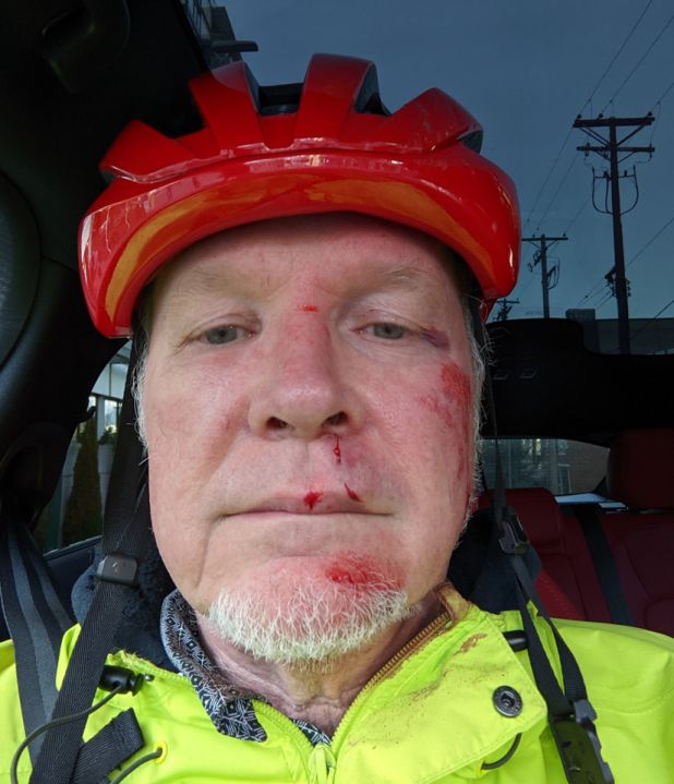 Grey-bearded white man with multiple facial wounds, wearing a bright red cycling helmet.