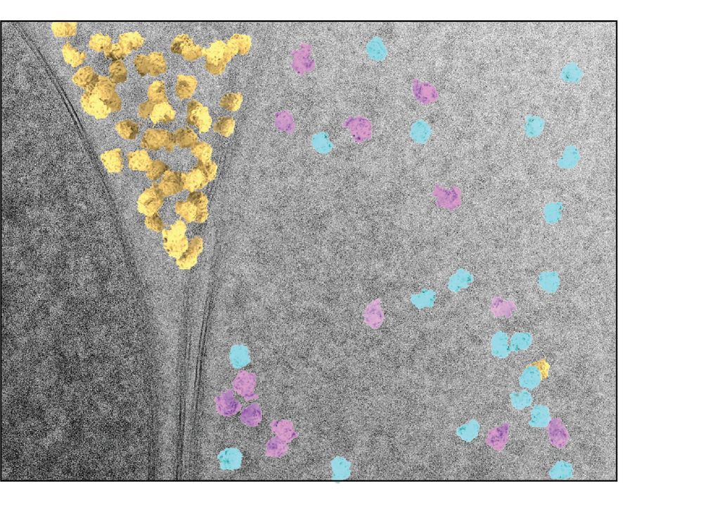 Individual ribosomes and ribosome precursors visualized inside a yeast cell.
