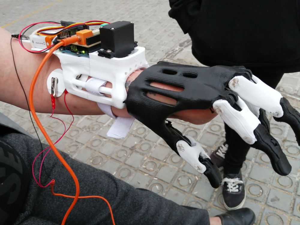 A custom-built robotic prosthetic hand made by Jorge Iglesias Costas, using an EMG sensor from Backyard Brains. The hand is black and white, made of plastic, and is being used by a person born without left-hand fingers.