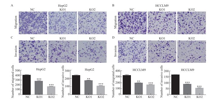 GSPT1 Functions as a Tumor Promoter in Human Liver Cancer
