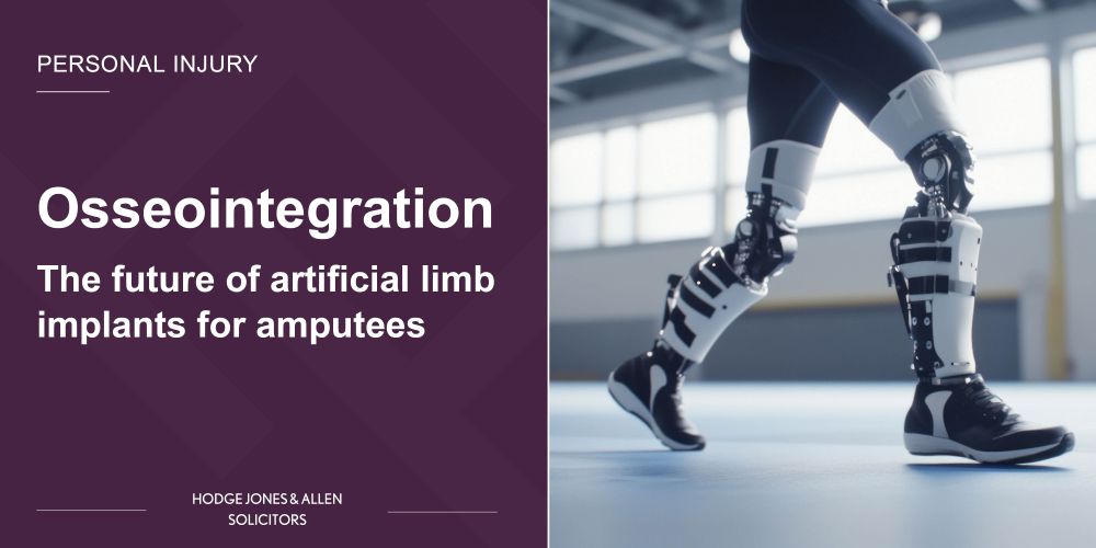 Image: Close-up of a person walking with advanced robotic prosthetic legs in a bright indoor space.

Text: Osseointegration - The Future of Artificial Limb Implants for Amputees