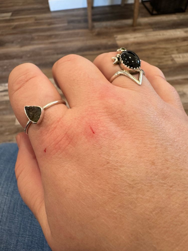 Close of of a hand wearing two rings with claw marks 