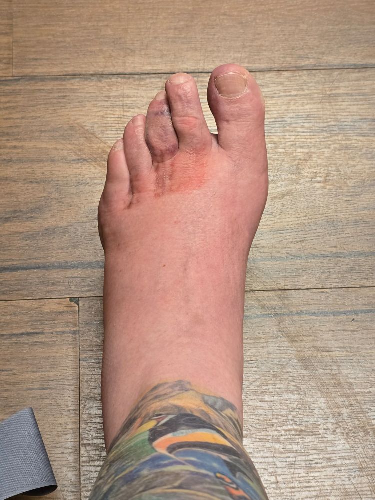 Foot