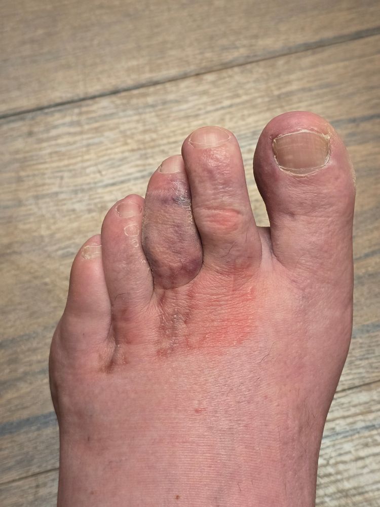 Foot