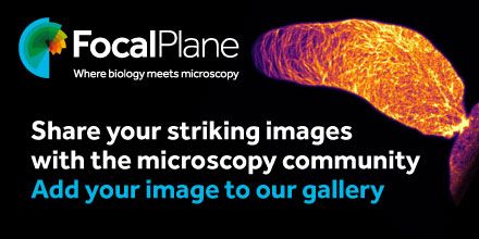 FocalPlane logo
Where biology meets microscopy

Share your striking images with microscopy community 
Add your image to our gallery. 