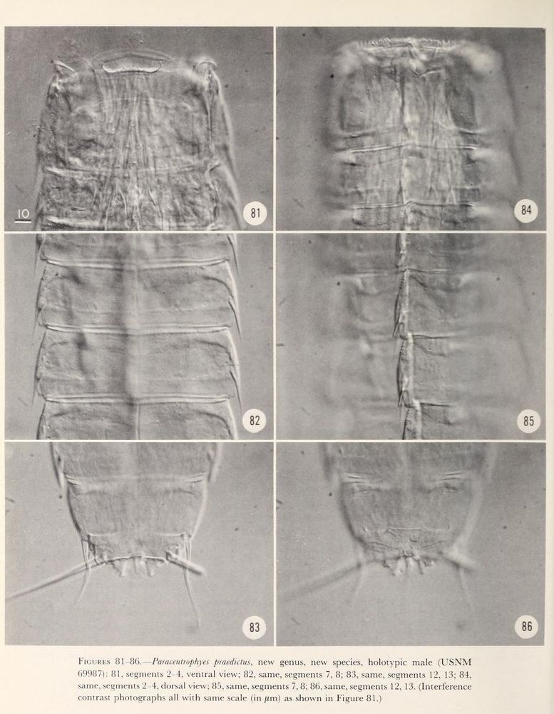 Microscope images of P. praedictus male. The text below reads:

"FIGURES 81-86. - Paracentrophyes praedictus, new genus, new species, holotypic male (USNM 69987): 81, segments 2-4, ventral view; 82, same, segments 7, 8; 83, same, segments 12, 13; 84, same, segments 2-4, dorsal view; 85, same, segments 7, 8; 86, same, segments 12, 13. (Interference contrast photographs all with same scale (in μm) as shown in Figure 81.)"