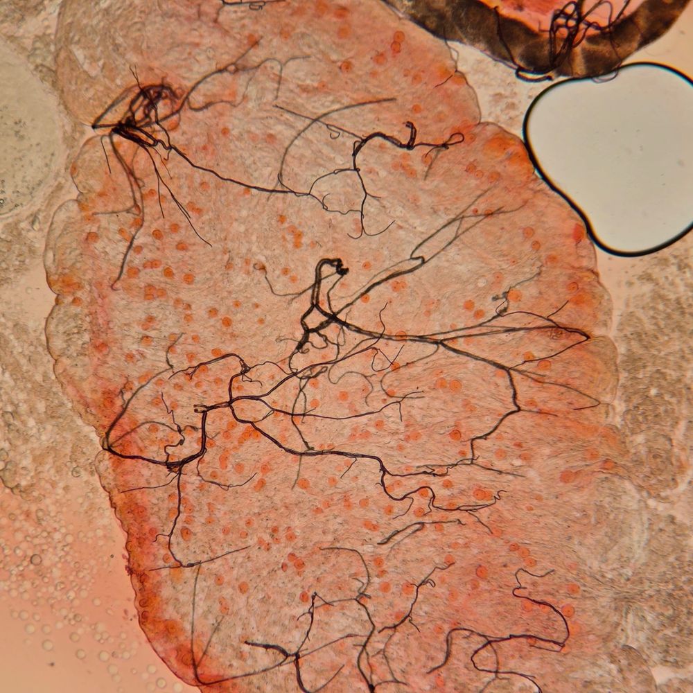 The image shows  Anopheles coluzzii mosquito midguts heavily infected with Plasmodium falciparum oocysts (orange circles). Each single oocyst can produce around 10,000 sporozites that have the potential to infect a human with malaria when the mosquito next bites.
