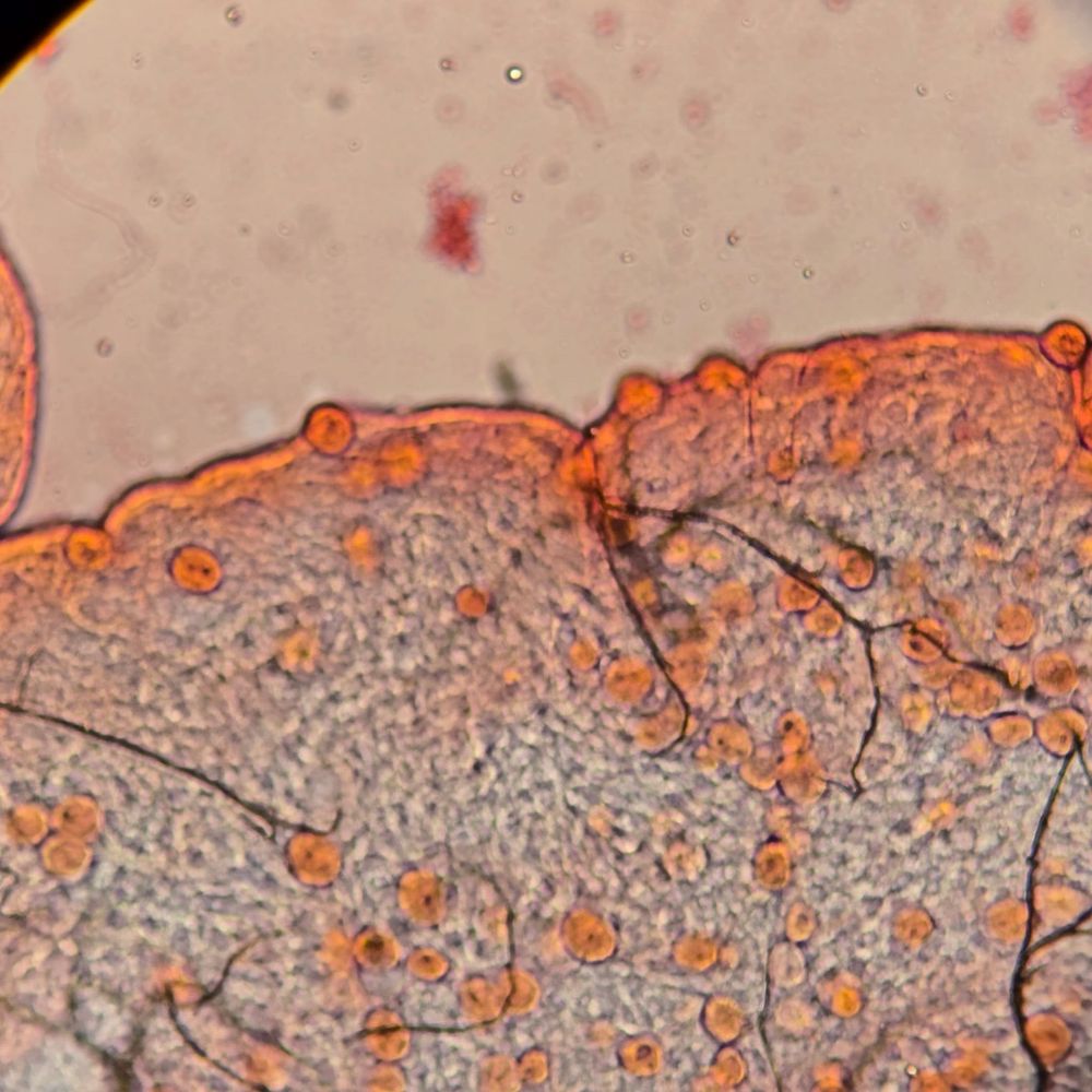 The image shows  Anopheles coluzzii mosquito midguts heavily infected with Plasmodium falciparum oocysts (orange circles). Each single oocyst can produce around 10,000 sporozites that have the potential to infect a human with malaria when the mosquito next bites.