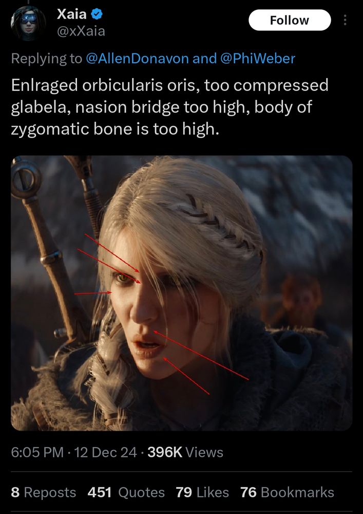 Tweet with a picture of Siri from The Witcher. Tweet reads" in the large orbital oris, two compressed glabella, nasion bridge too high, body of zygomatic bone too high."