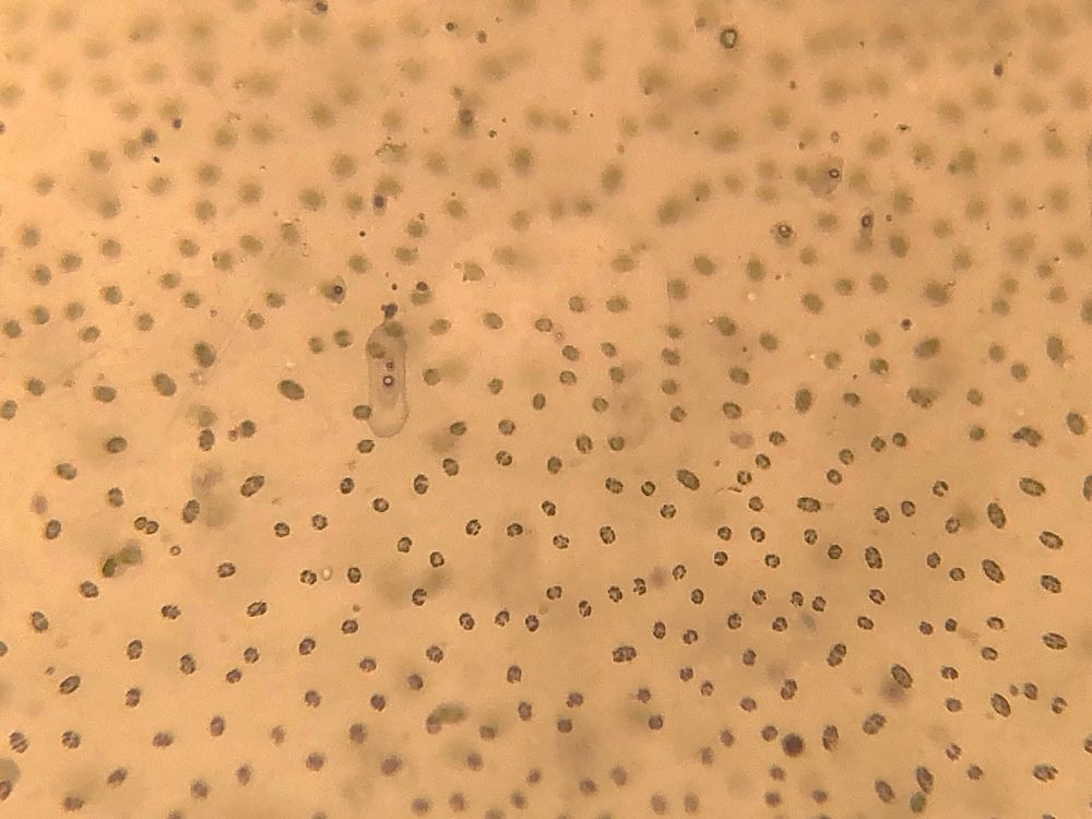 Close up (10x magnification) of the dots lining the circular blobs 