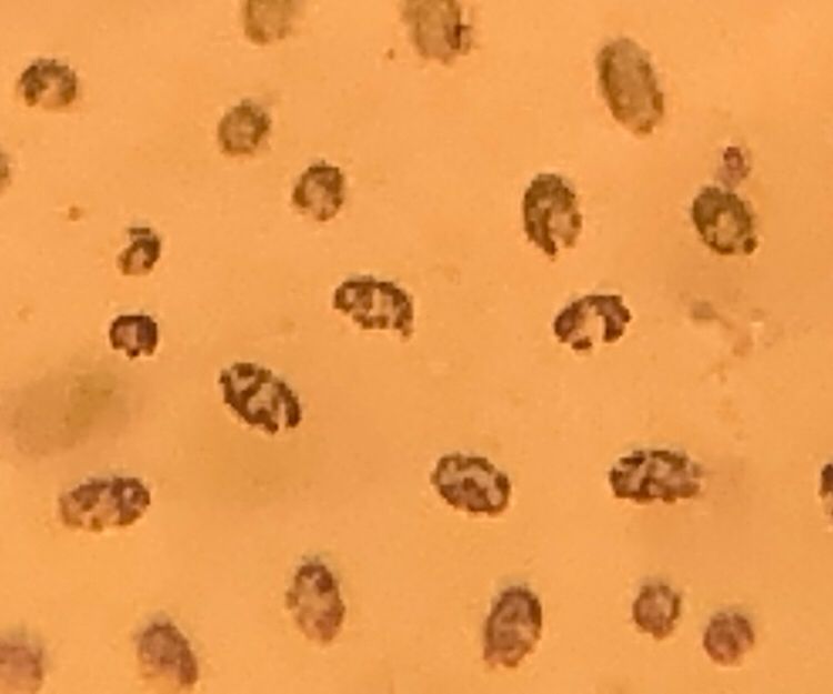 iPhone digital zoom of said dots, showing MORE dots surrounding the dots 