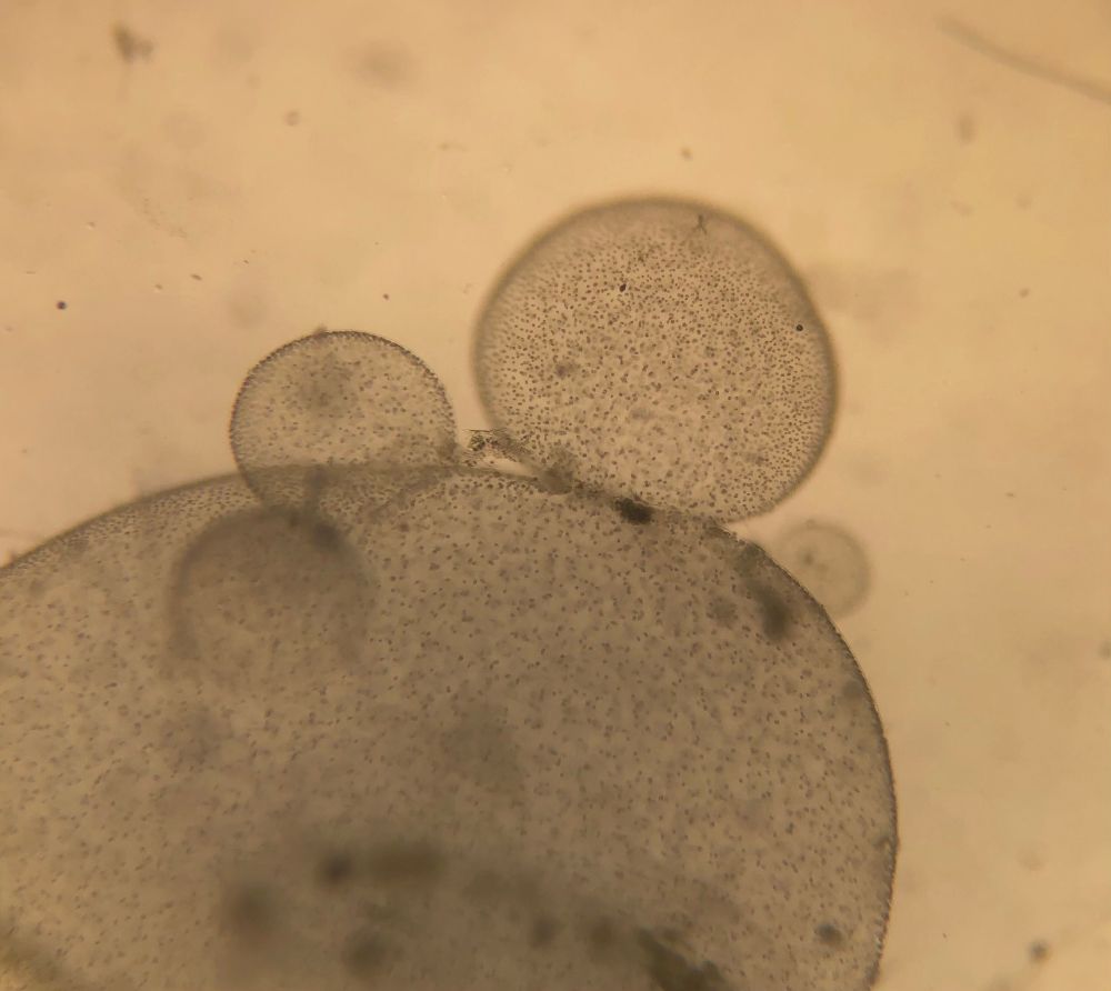 Round circular blobs with dots that are presumably cells 