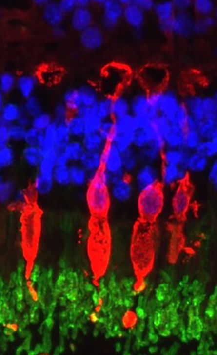 Fluorescent microscopic image of rods and cones showing club like cone pedicles (synaptic terminals)in the outer plexiform layer of the human retina