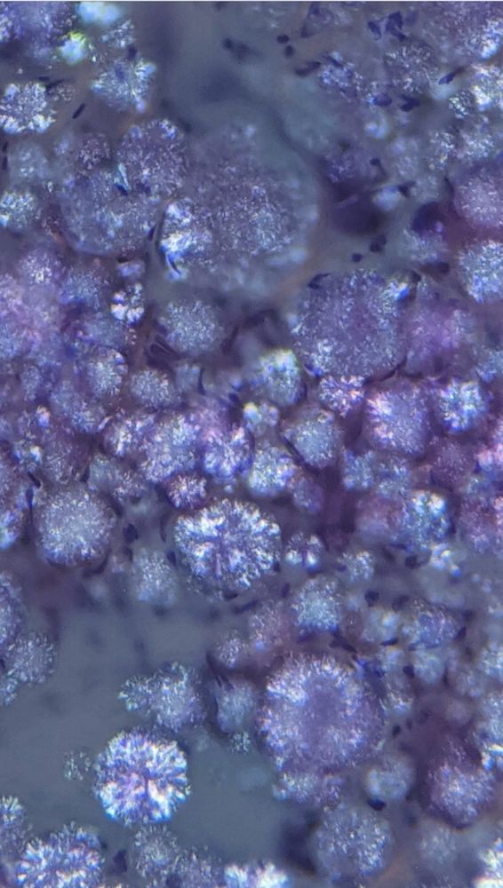Same specimen after polarization highlighting the refractory nature of the material 