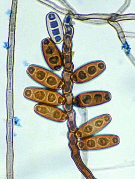 Photomicrograph of Curvularia australiensis, formerly Bipolaris australiensis