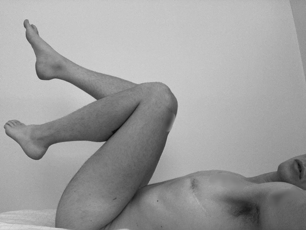 A black and white photo of Cedar, nude, on their back, legs kicking in the air, lips parted, one arm reaching out for you. Their tattoos are blurred for privacy