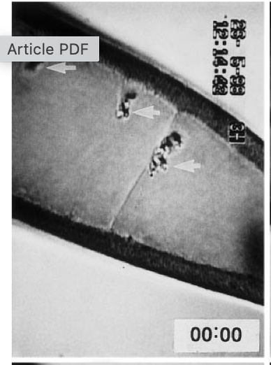 Image with large crystals at the top of the cell, after the cells was quickly rotated