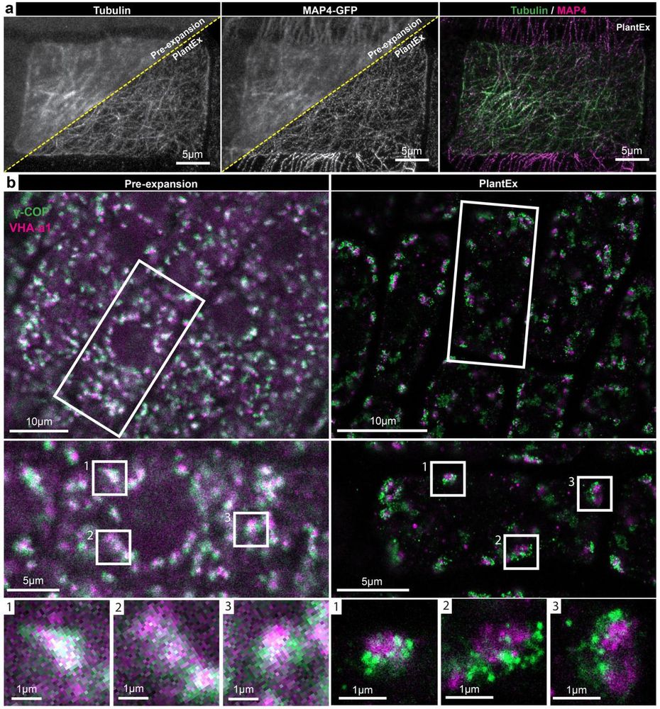 Golgi vesicles can be visualized at super-resolution in Arabidopsis thaliana roots via PlantEx expansion microscopy.