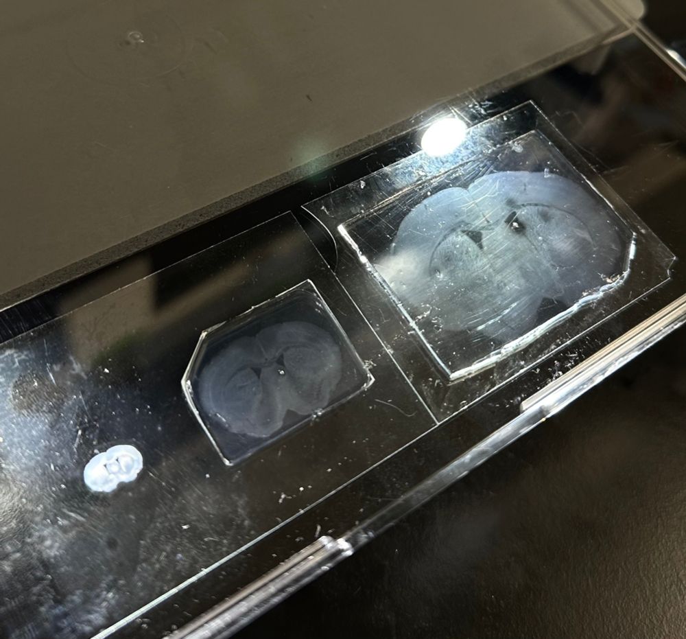 Mouse brain slices, unexpanded and at two different expansion levels, prepared using expansion microscopy.