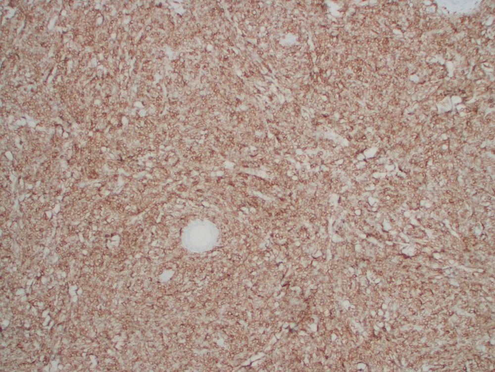 CD79a