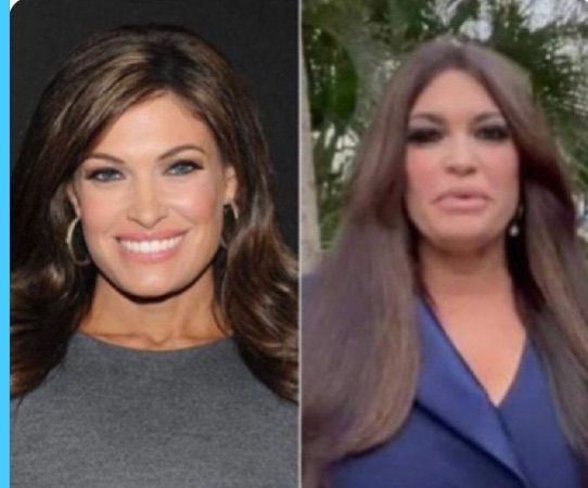 Picture of Kim Guilfoyle as a younger woman, and as she appears now after having multiple surgeries and other procedures that have completely changed her appearance.