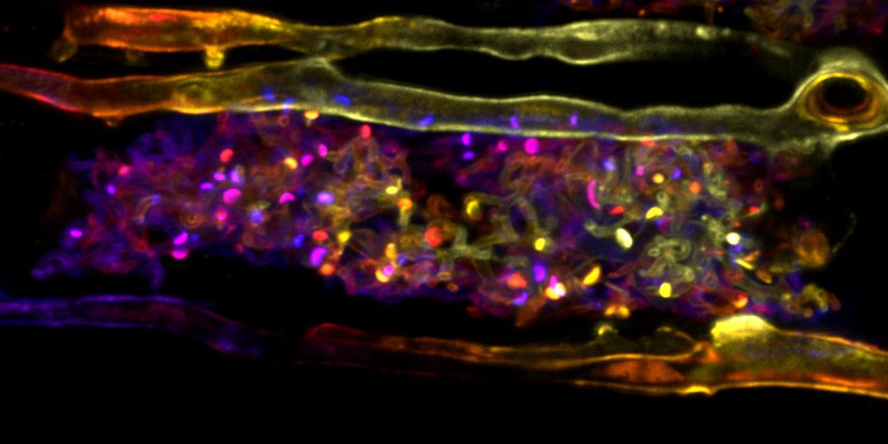 Thick fungal hyphae around a cells with an arbuscule inside the cell, false-coloured with 'fire' colours to depict 3D structure.