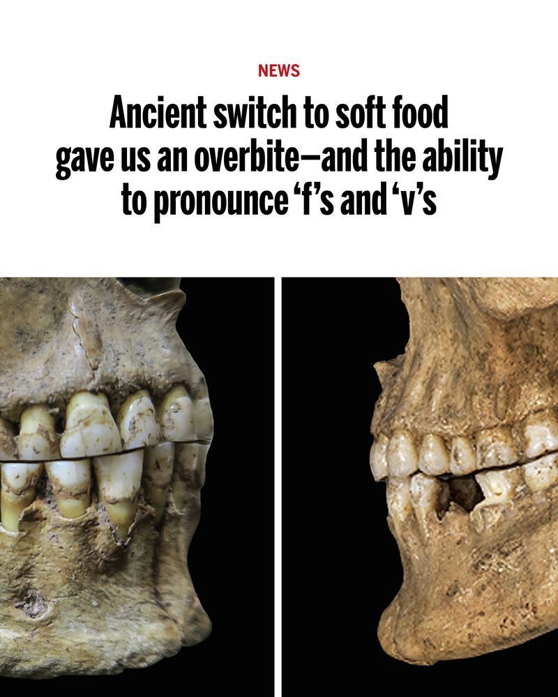 An ancient woman from Romania shows an edgeto-edge bite (left). A Bronze Age man from Austria had a slight overbite (right). Hedline reads: Ancient switch to soft food gave us an overbite—and the ability to pronounce ‘f’s and ‘v’s