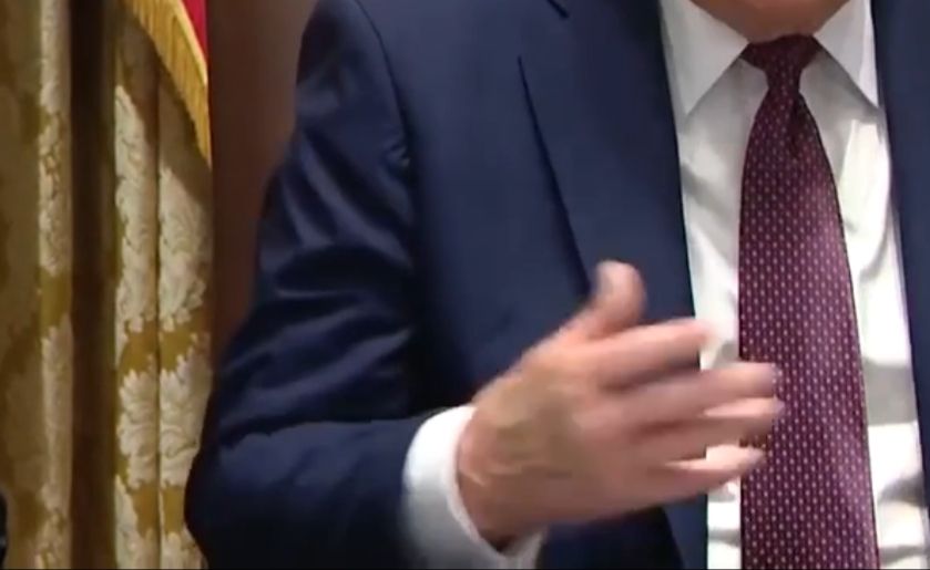 Still frame from quoted video share post - cropped in zoom image of the back of Trump's right hand - the video is blurred, but even so, you can see how clearly discoloured and bruised his hand is.