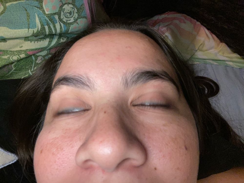 Jennifer’s freshly plucked eyebrows 