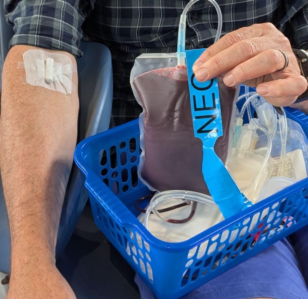Bag of o negative blood being held up. 