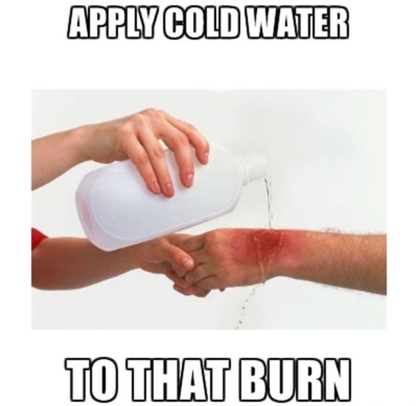 Stock photo on plain white background of a hand holding another hand with a red burn on it, while pouring a jug of water on it. The text with classic meme format outlined Impact font reads: 