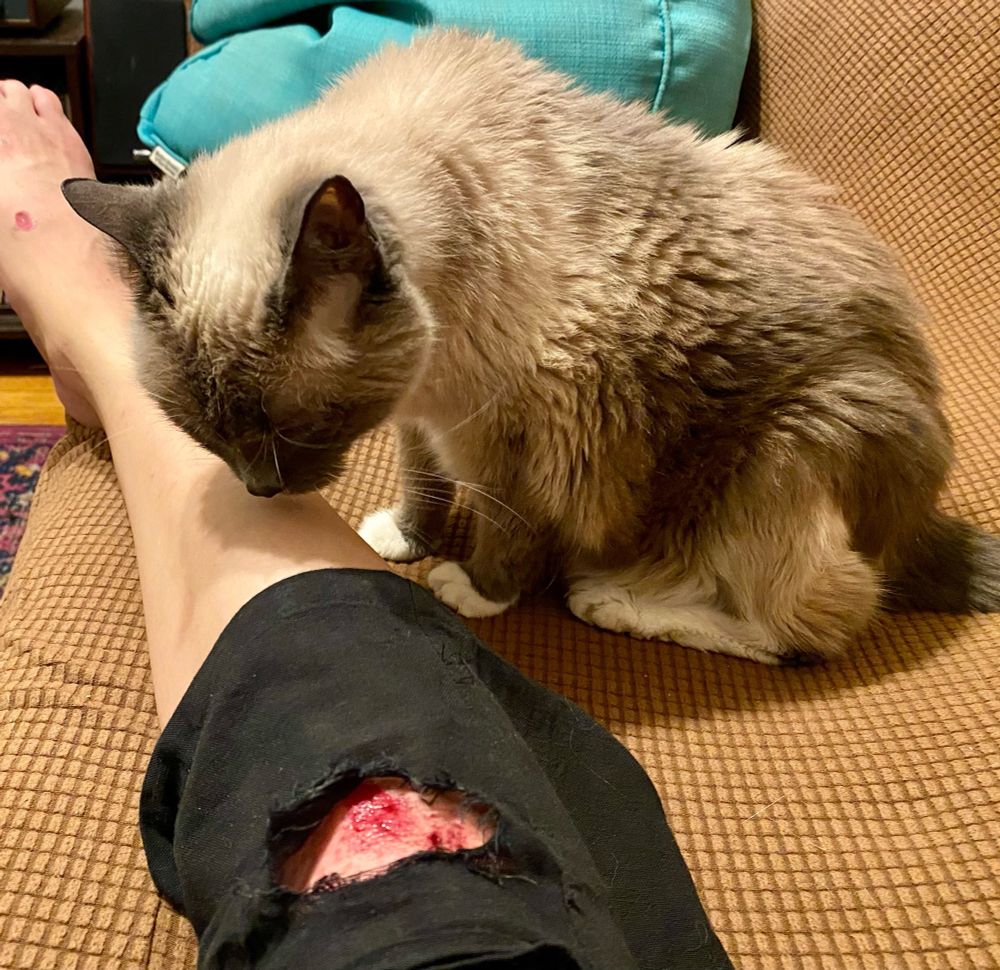 Woman’s leg with a skinned knee and a hole in her black capris. Her cat is licking her injured leg 