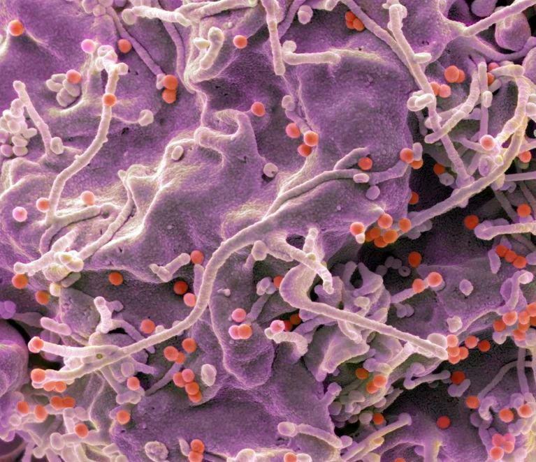 HIV particles (red dots) enter cells using proteins that bind to the cell membrane which is lavender in color Credit: Steve Gschmeissner/Science Photo Library