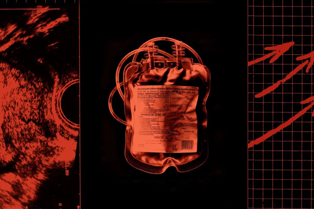 blood bag, ultrasound picture, chart up all in black and red tones.