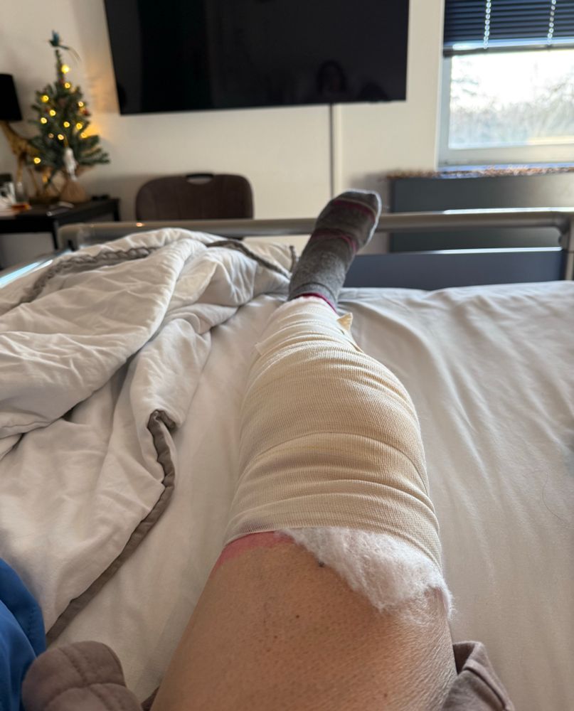 Een been net drukverband om de knie. In een ziekenhuisbed. Kerstboompje op de achtergrond 🎄