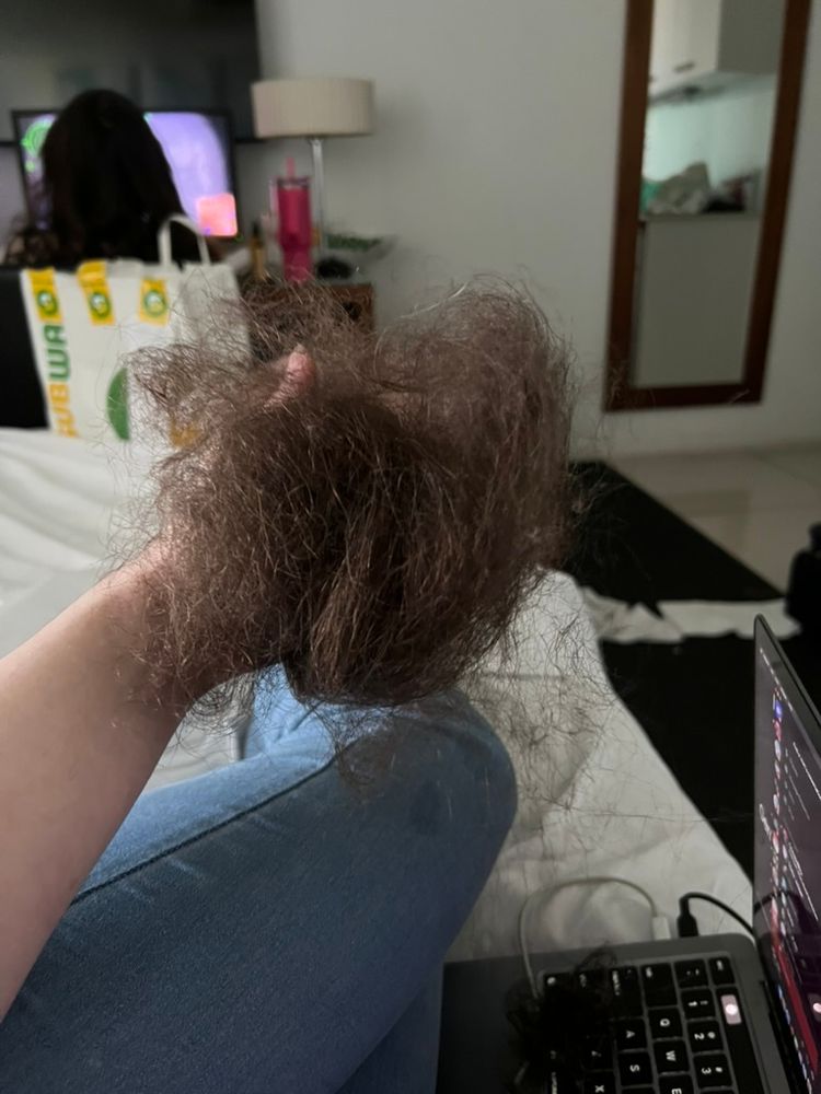  A person sitting on a bed holds a large clump of tangled brown hair in their hand, suggesting significant hair shedding or loss. They are wearing light blue jeans, and a laptop with visible cords sits on the bed nearby. In the background, another person with long dark hair sits facing a TV, with a reusable shopping bag and pink drink bottle visible on a small table. A standing lamp, mirror, and partially visible kitchen are also seen in the room, suggesting a lived-in, casual domestic setting.