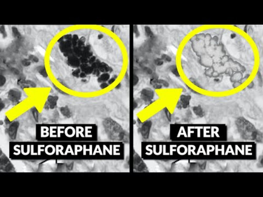 We Finally Know How To Detox Microplastics From Our Cells