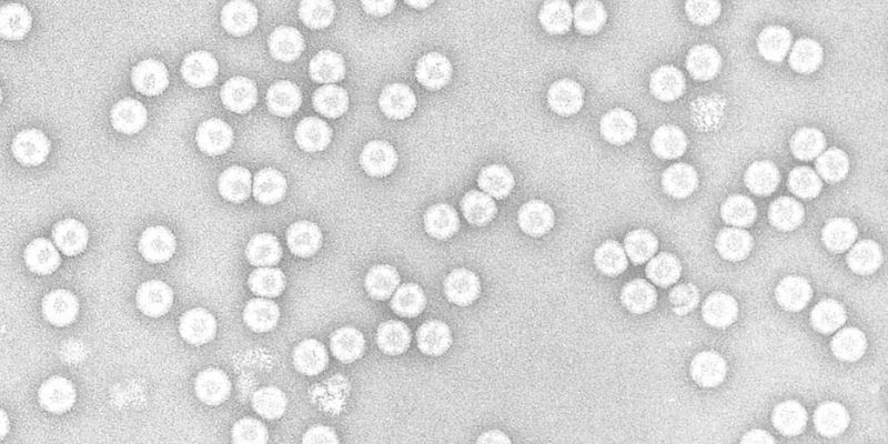 TEM virus_Multiple white circles on a grey background
