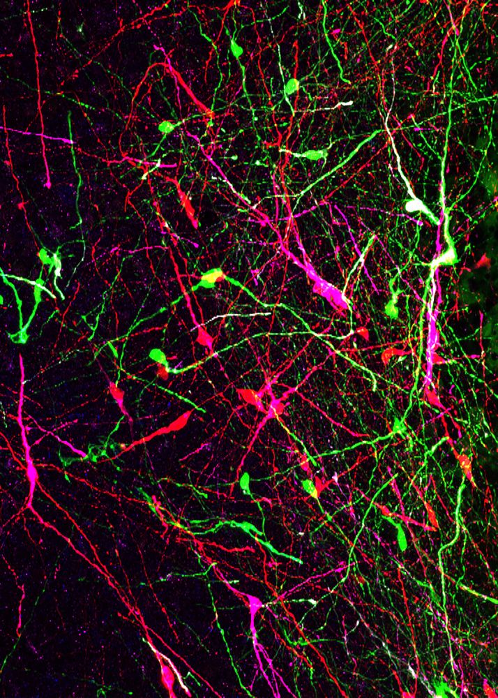 Lines of red, green, and purple on a black background show human Fragile X neurons and control neurons.
