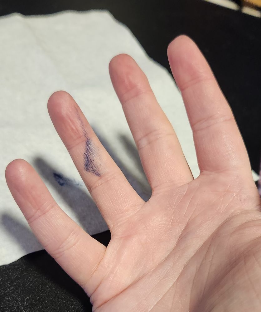 hand facing up to reveal a streak of smudged nail polish down one finger
